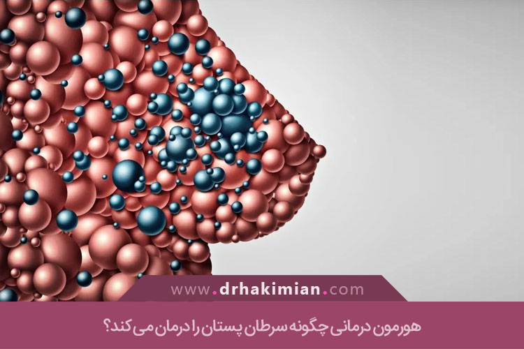 هورمون درمانی در سرطان پستان