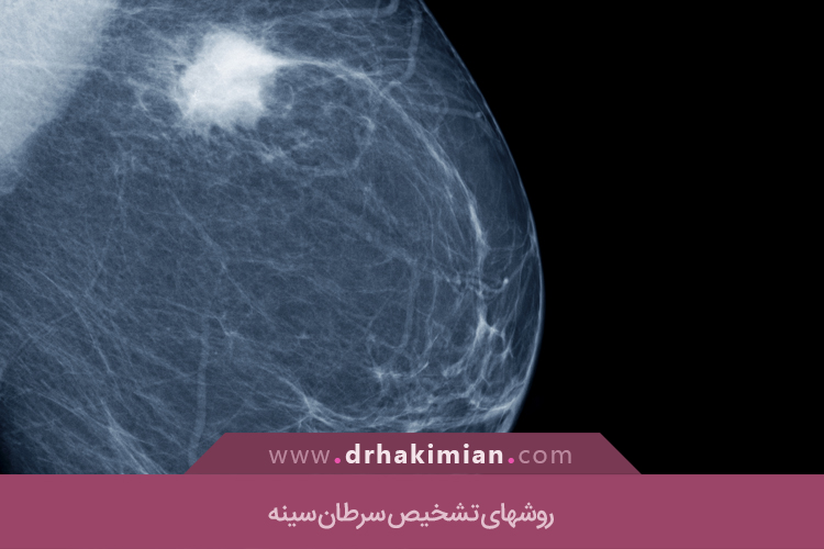 روشهای تشخیص سرطان سینه