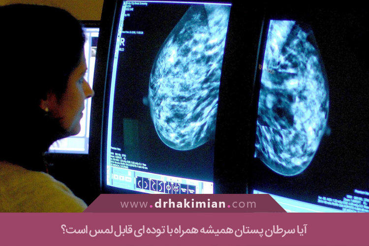 توده های سرطانی پستان