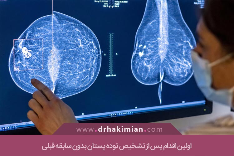 تشخیص توده پستان