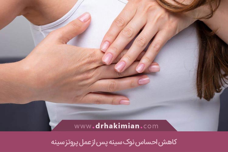 کاهش احساس نوک سینه پس از عمل پروتز سینه