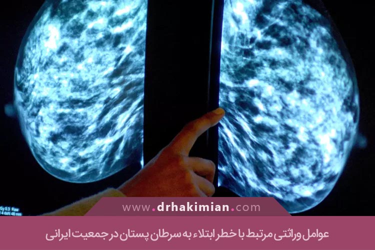 سرطان پستان در جمعیت ایرانی