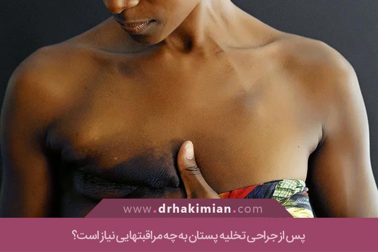 مراقبتهای بعد از عمل تخلیه پستان