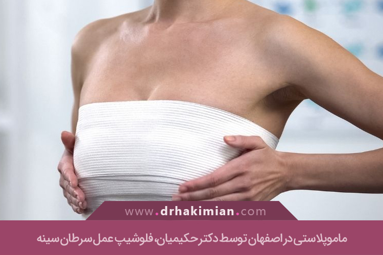 ماموپلاستی در اصفهان
