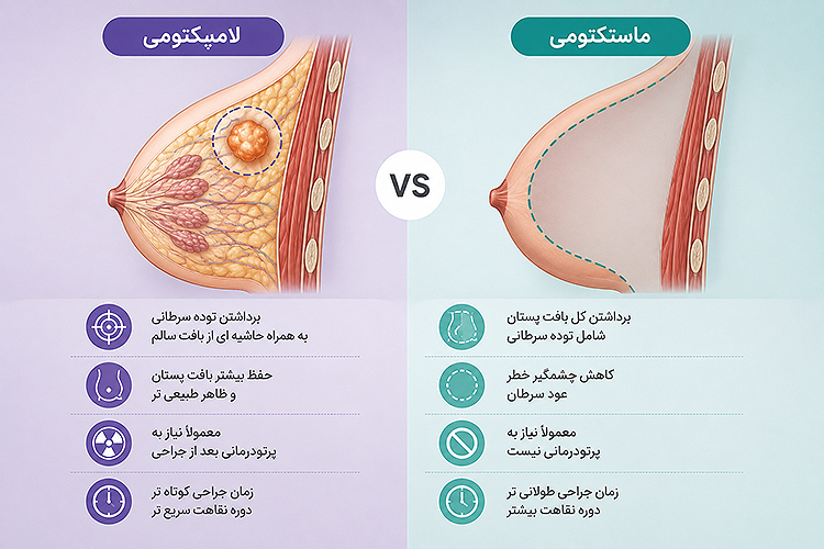 تفاوت روش‌های جراحی سرطان سینه در اصفهان