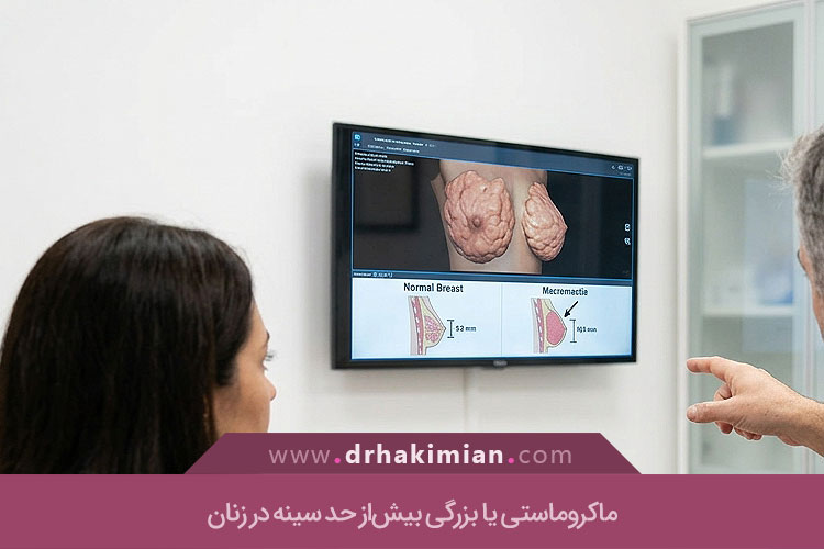 ماکروماستی چیست