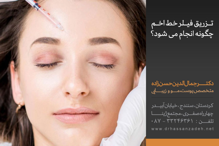 تزریق فیلر خط اخم