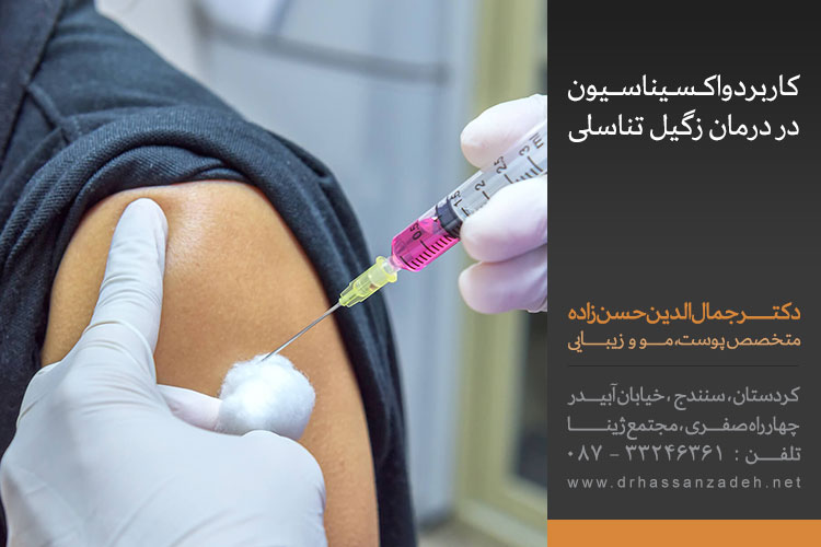 کاربرد واکسیناسیون در درمان زگیل تناسلی