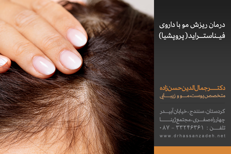 درمان ریزش مو با داروی فیناستراید