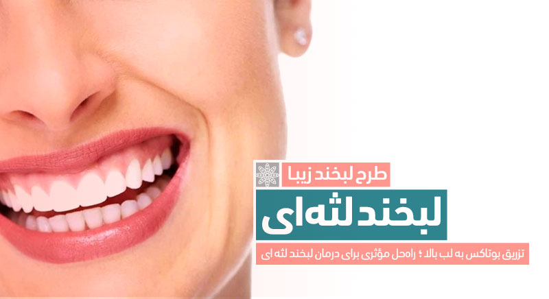 لبخند لثه ای گامی اسمایل gummy smile کلینیک دکتر پرستو خسروانی بهترین متخصص پوست، مو و زیبایی شهرکرد اصفهان تهران ایران