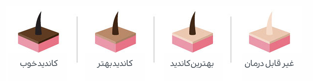 بهترین کاندید لیزر موهای زائد پوست روشن و موی تیره کلینیک دکتر پرستو خسروانی بهترین متخصص پوست، مو و زیبایی شهرکرد و ایرن