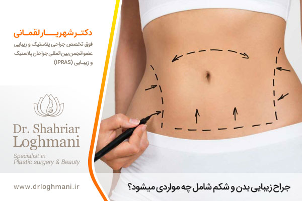 جراحی زیبایی بدن در اصفهان