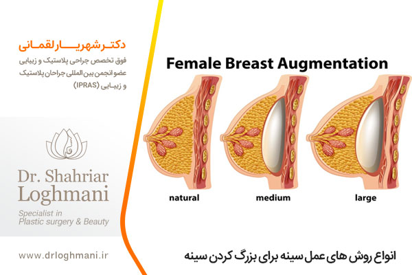 جراحی بزرگ کردن سینه