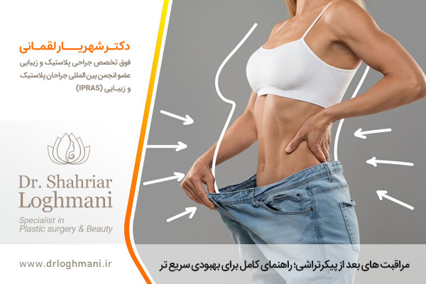 مراقبت های بعد از پیکر تراشی