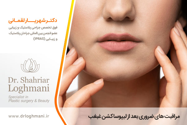 مراقبت های بعد از لیپوساکشن غبغب 