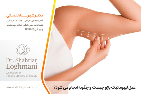 عمل لیپوماتیک بازو چگونه انجام می شود