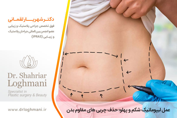 لیپوماتیک شکم