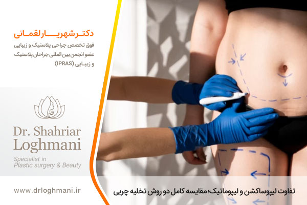 فرق لیپوماتیک و لیپوساکشن
