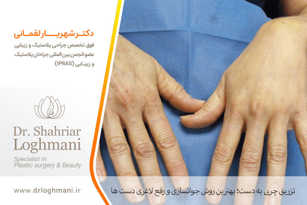 عکس تزریق چربی به دست