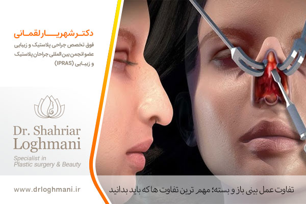 فرق عمل باز و بسته بینی