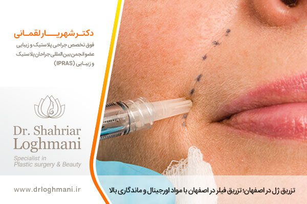 تزریق ژل در اصفهان 