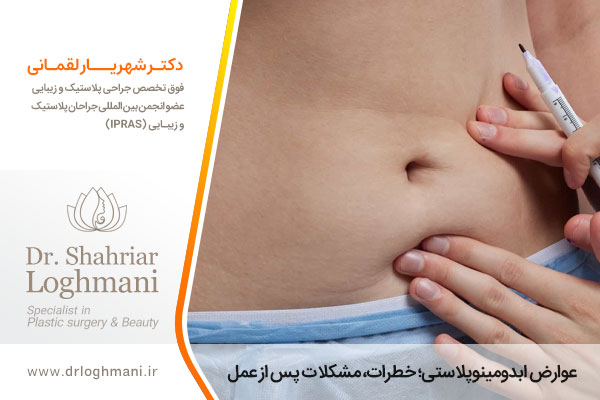 عوارض ابدومینوپلاستی 