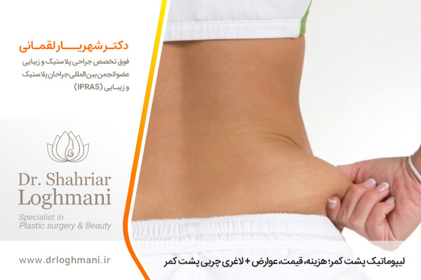 لیپوماتیک پشت کمر 