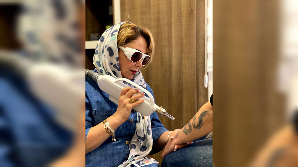 لیزر کیوسوییچ