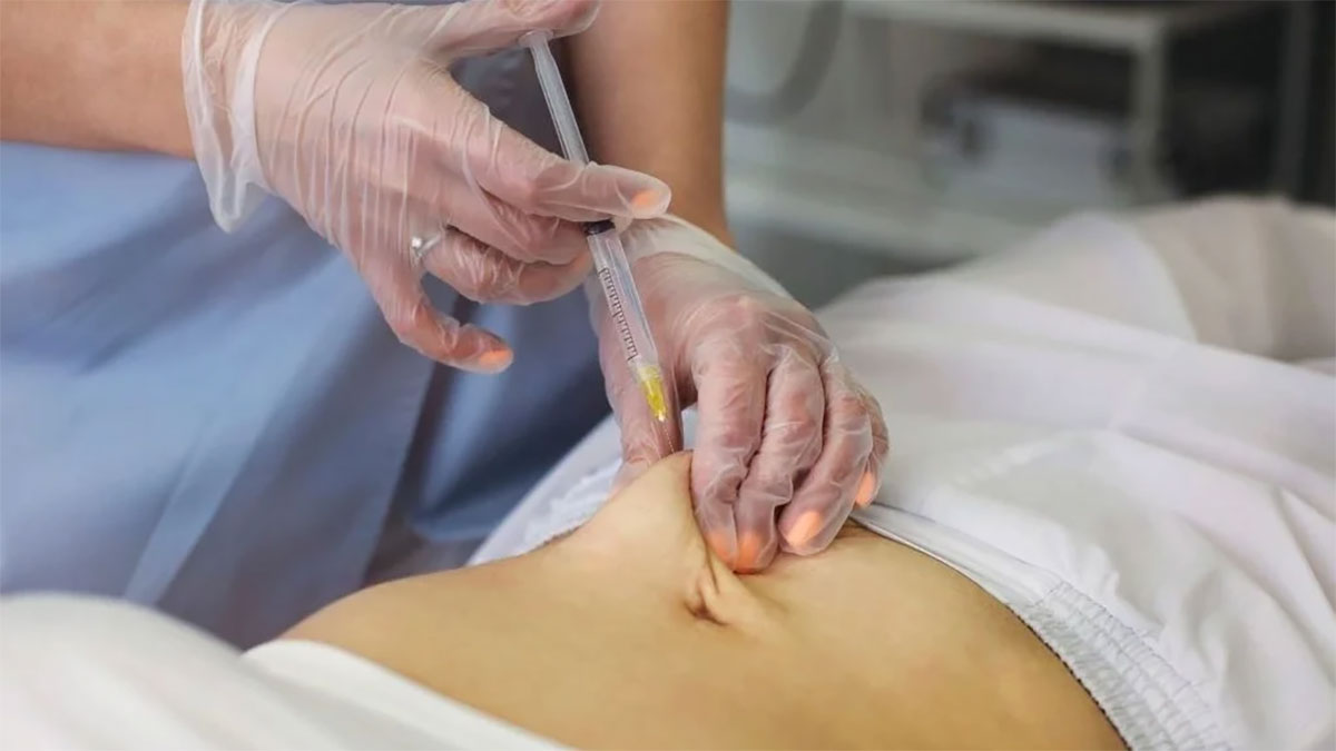 مزوتراپی لاغری