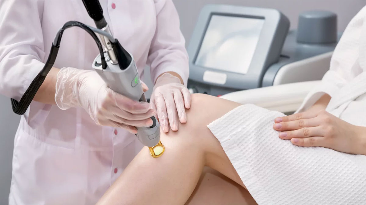 لیزر فول بادی