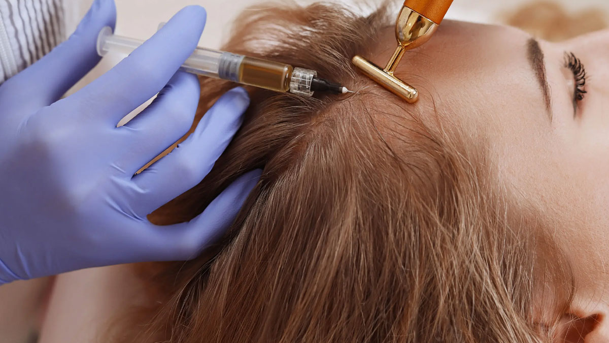 مزوتراپی مو 