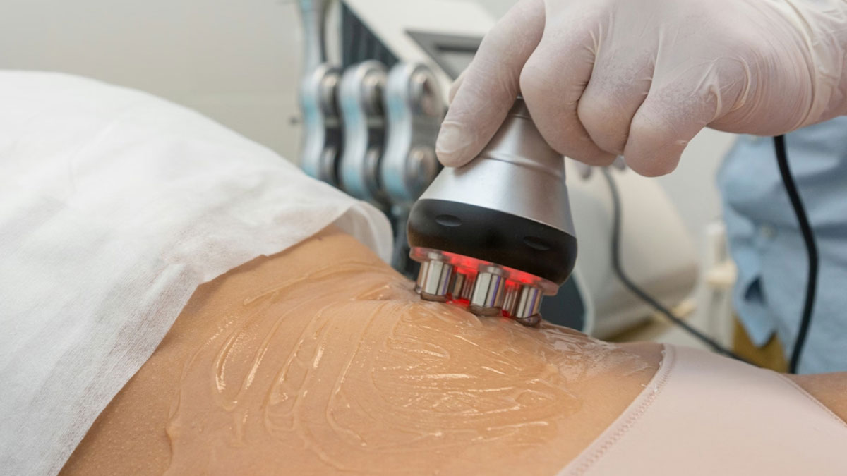 آر اف لاغری 