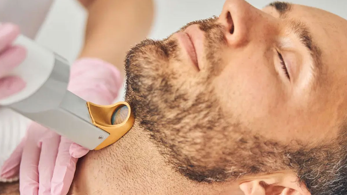لیزر موهای زائد مردان 