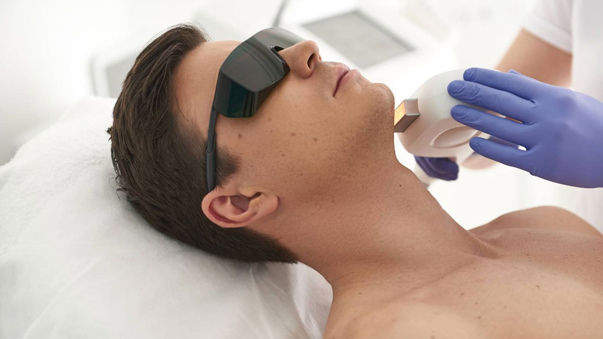 لیزر موهای زائد آقایان 