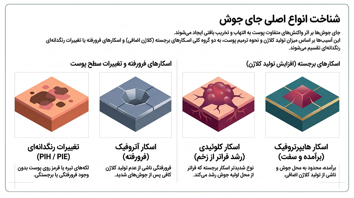 راهنمای شناخت جای جوش