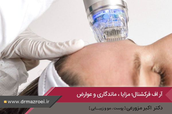 عکس آر اف فرکشنال