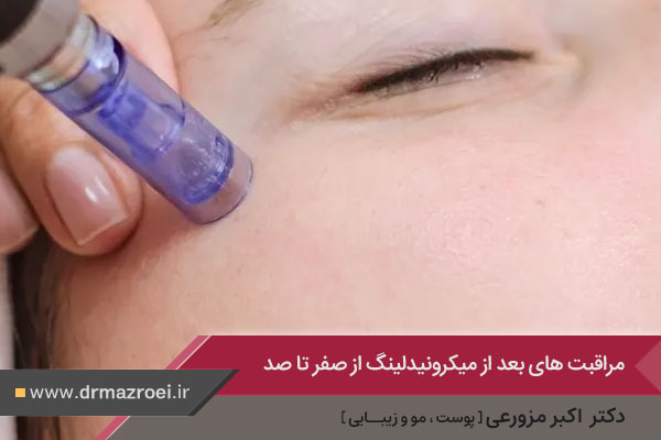 مراقبت بعد از میکرونیدلینگ