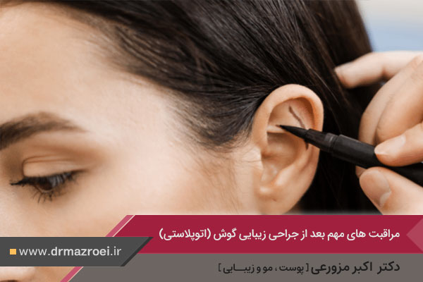 مراقبت‌های پس از جراحی اتوپلاستی