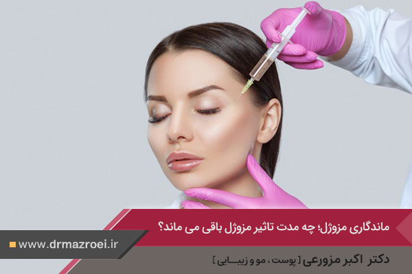 ماندگاری مزوژل صورت