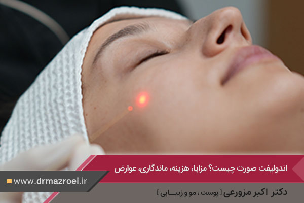 اندولیفت صورت