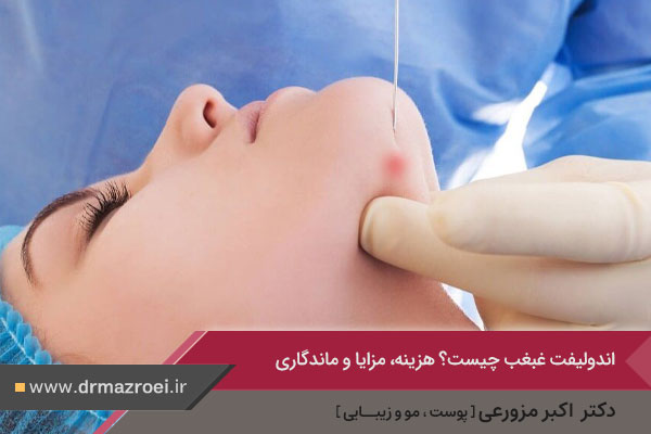 اندولیفت غبغب 