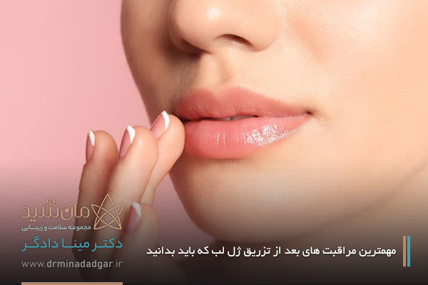 مراقبتهای پس از تزریق ژل لب
