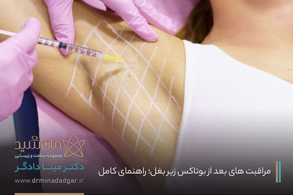 مراقبت بعد از تزریق بوتاکس زیر بغل