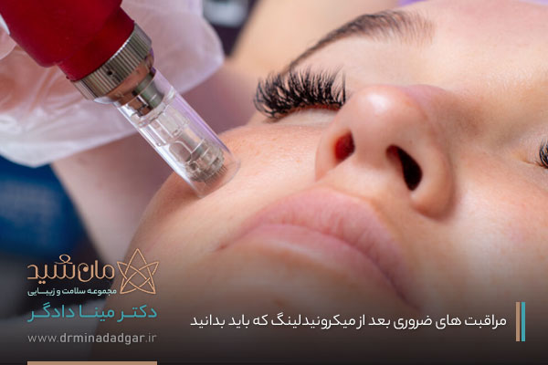 مراقبت بعد از میکرونیدلینگ