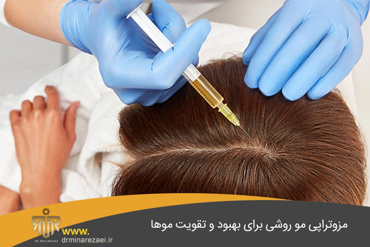 مزوتراپی مو