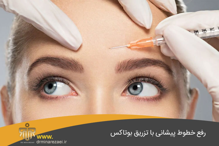 رفع خطوط پیشانی با تزریق بوتاکس