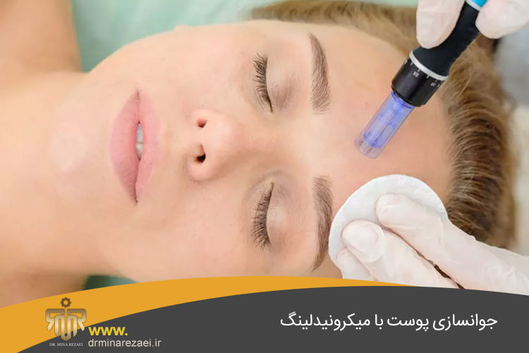 جوانسازی پوست با میکرونیدلینگ