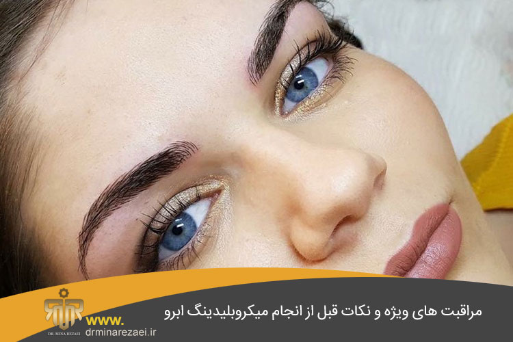 مراقبت های بعد از میکروبلیدینگ