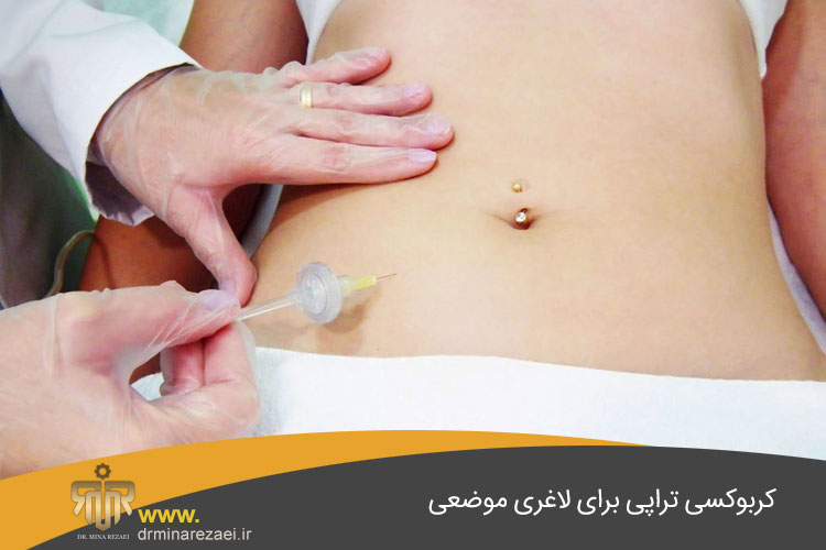 کربوکسی تراپی لاغری