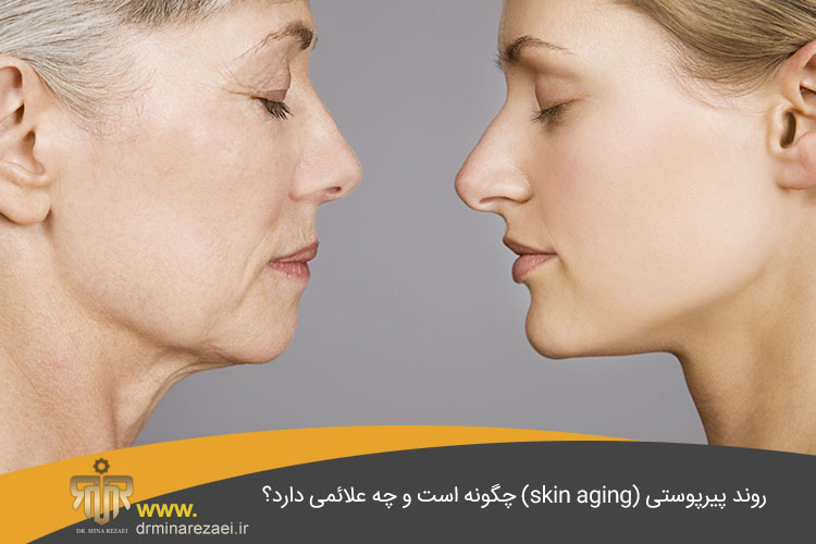 پیری پوست